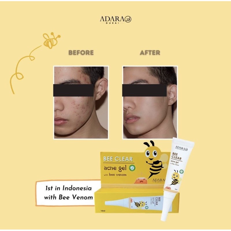 ADARA - Bee Clear Acne Gel With Bee venom / Obat Totol Jerawat