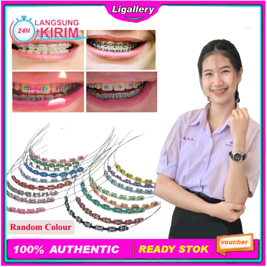 [BISA COD] Behel Gigi Lepas Pasang Murah Kawat Behel Warna Behel Atas Bawah Lepas Pasang Fashion Ane