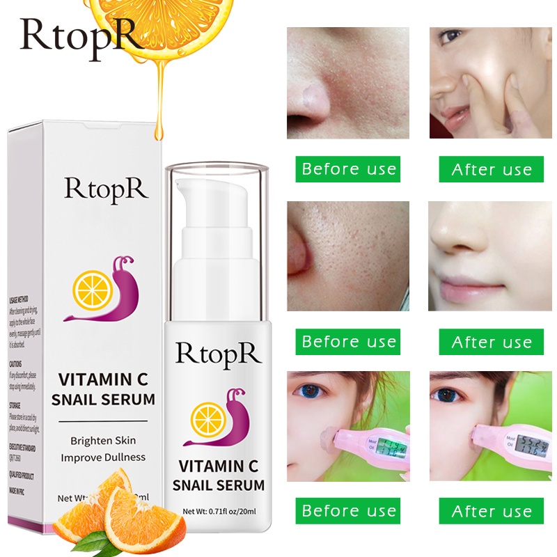 [100% Asli] RtopR Vitamin C Serum Snail Anti Aging Serum Wajah Kontrol Minyak Esensi Pelembab Pemutih Pengecil Pori-pori Anti Penuaan Serum Vitamin C Asam Hyaluronik