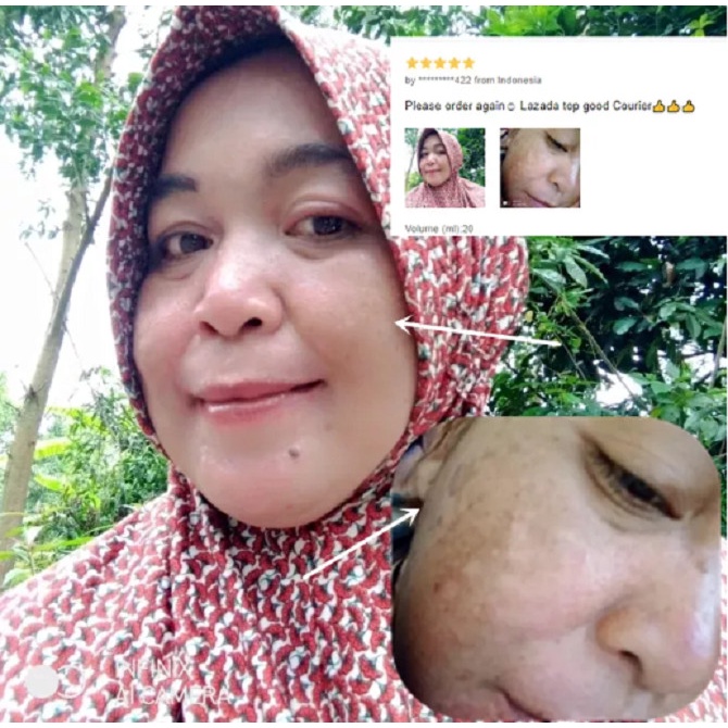 COD Pembersih Flek Bintik Hitam di Wajah Krim Pemutih Black Spot Cleaner on Face Krim Pemutih Penghilang Keriput