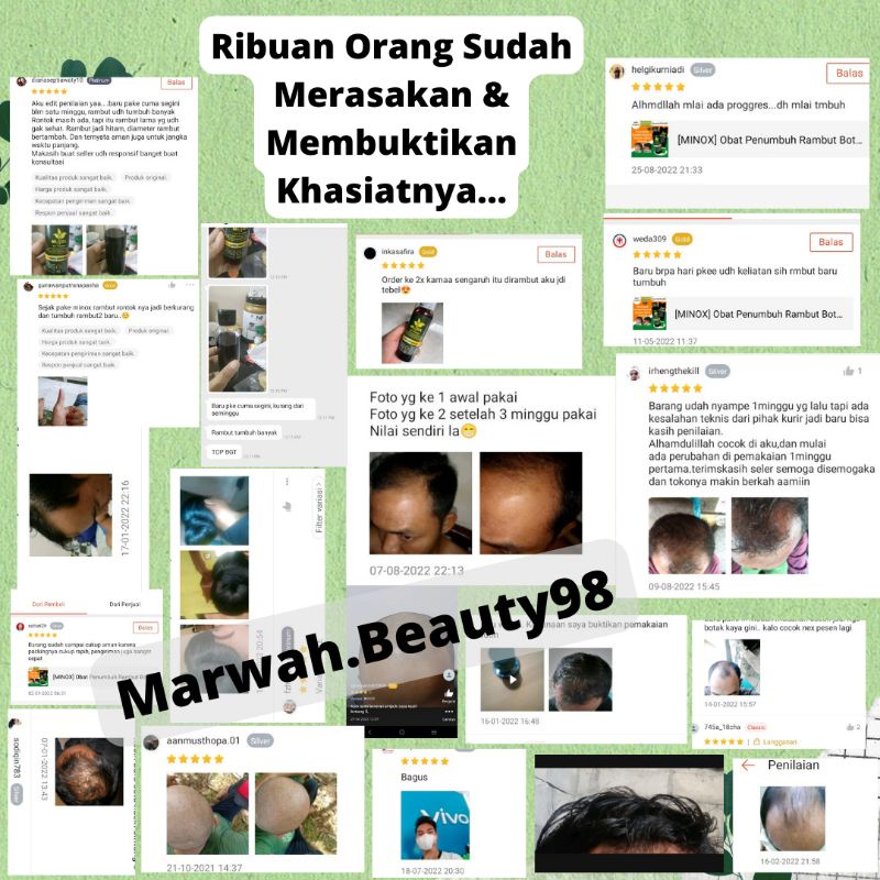 [MINOX] Obat Penumbuh Rambut Botak, Tipis dan Rontok Super Cepat Original Ampuh isi 100 ML