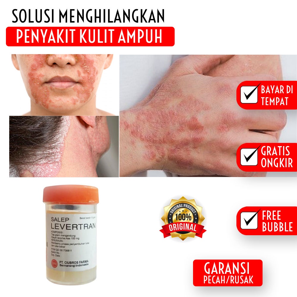 Salep Levertran Asli Original - Cream Levertran 24 Original Asli Salep Obat Gatal Kudis Kurap Panu K