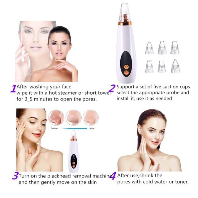 Penghilang Jerawat Komedo Titik Hitam Remover Alat Kecantikan Aspirateur Kulit