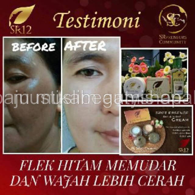 SPOT ESSENCE CREAM SR12 - TUMPAS BEKAS JERAWAT , FLEK HITAM &amp; NODA WAJAH