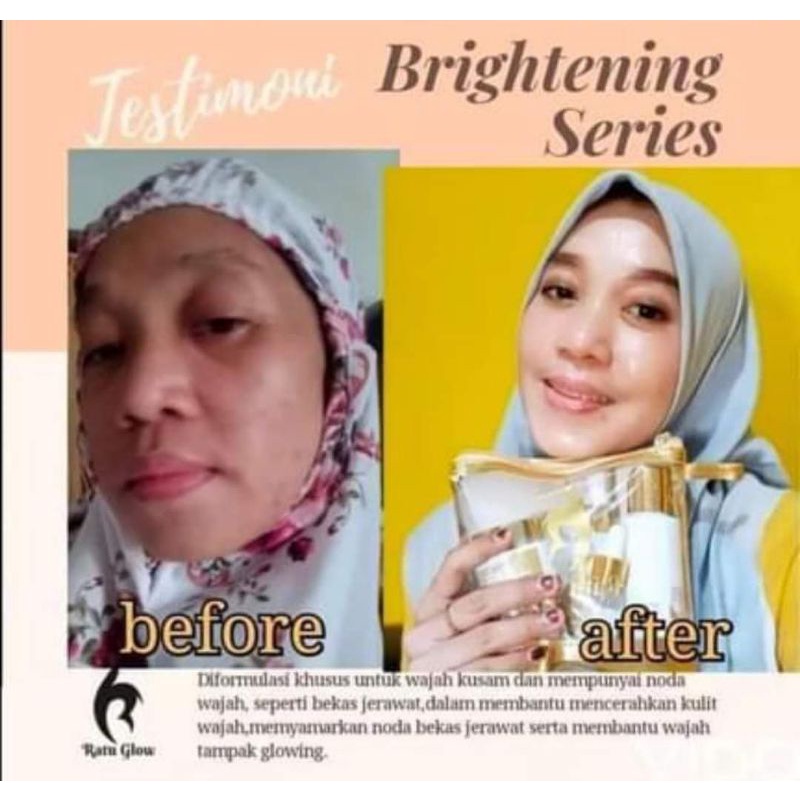 RATU GLOW SKINCARE PAKET BRIGHTENING BY OWNER APOTEKER AGUS SALIM