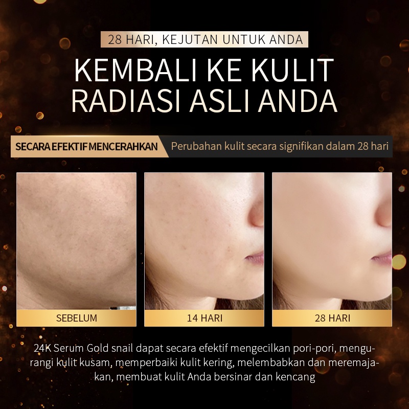 BPOM LAIKOU Emas 24k Serum Essence Siput Anti Penuaan Menghilangkan Garis-Garis Halus Kerutan 17ml