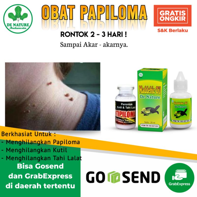 Obat Penghilang Papiloma Kondiloma Kutil dan Tahi Lalat di Leher Wajah Muka Kelamin Ampuh