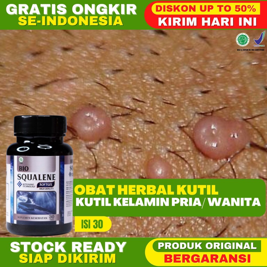 Obat Kutil Propolis sm Kutil Kelamin Pria Kutil Kelamin Wanita Kutil Wajah Salep Kutil Softgel