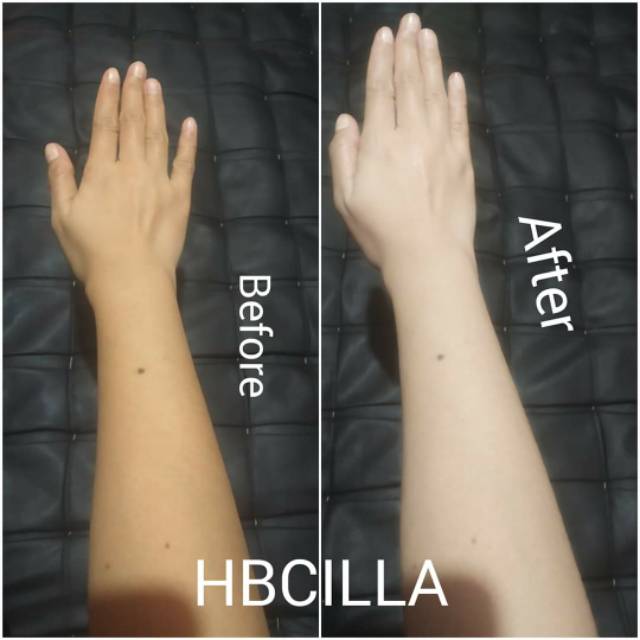 Testimoni hb cilla by ridwan pasha / hb viral / hb dosis tinggi aman / body lotion / hand and body