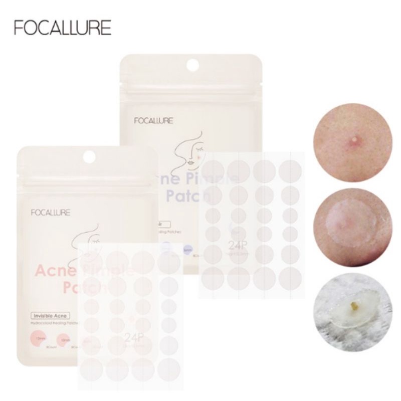 Focallure Acne Patch