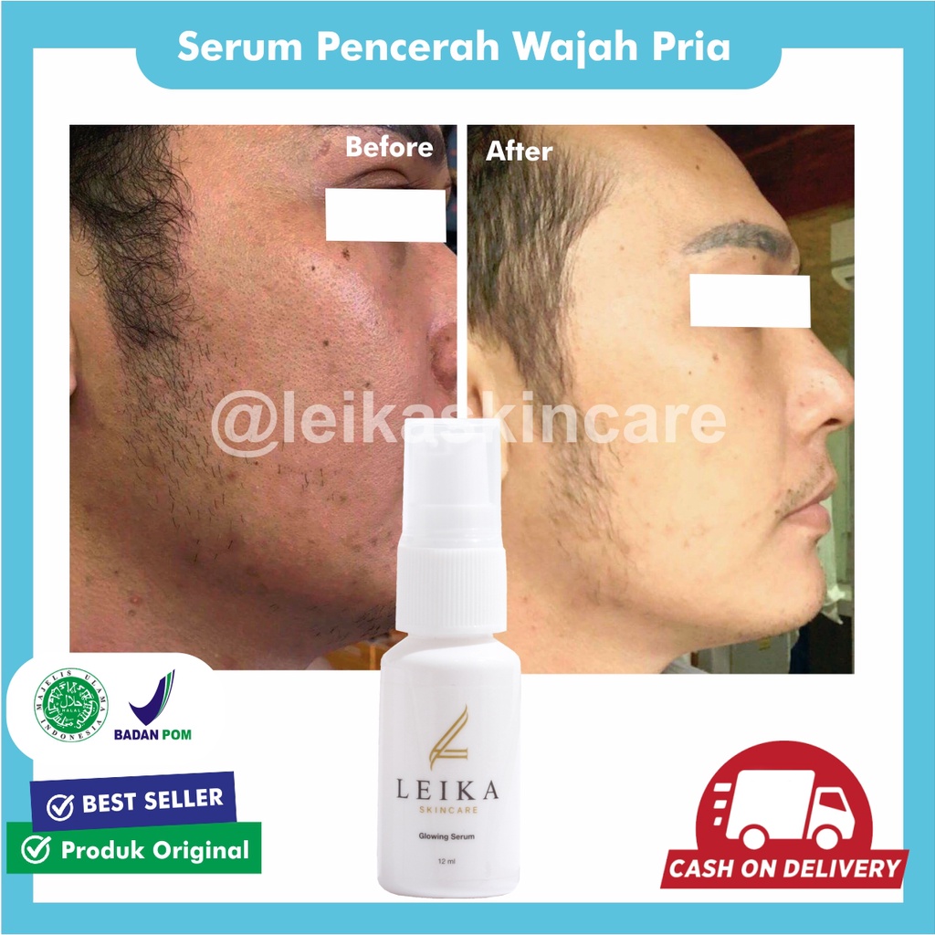 AMPUH Serum Wajah Pencerah Wajah Pria Perawatan Wajah Kusam Serum Glowing Pemutih Wajah Glowing Seru