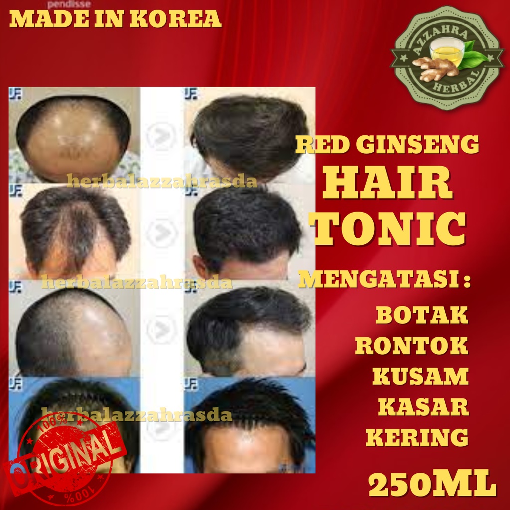 Red Ginseng Hair Tonic / Penumbuh Rambut Botak Pria Wanita dan Nutrisi Pencegah Kerontokan dari Bahan Natural