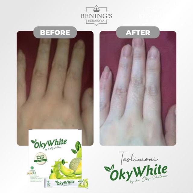 BENING'S OKYWHITE | MEMUTIHKAN &amp; MENCERAHKAN KULIT | BPOM &amp; HALAL | FREE GIFT SIAP KIRIM SELURUH INDONESIA