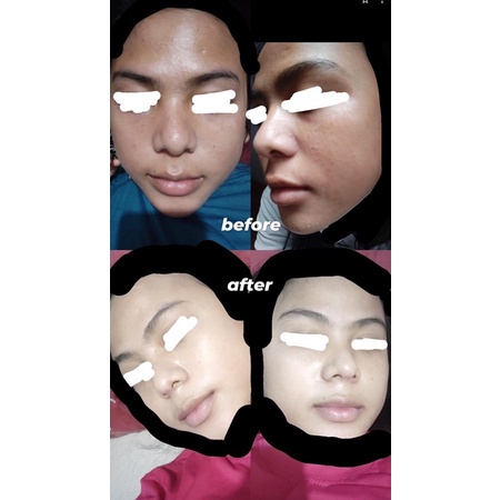 READY LANGSUNG KIRIM! TAMANU OIL BY PERLE BEAUTY 5ML BPOM TAMANU OIL MINYAK TAMANU BY PEARL BEAUTE BEAUTY  PEARLBEAUTYS