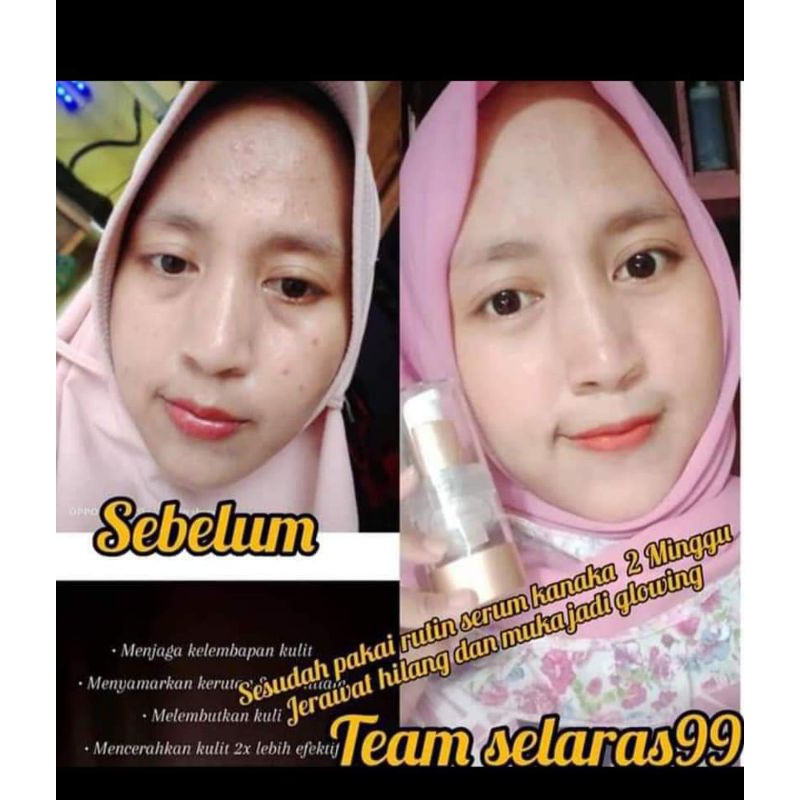 PROMO Serum gold/emas kanaka selaras