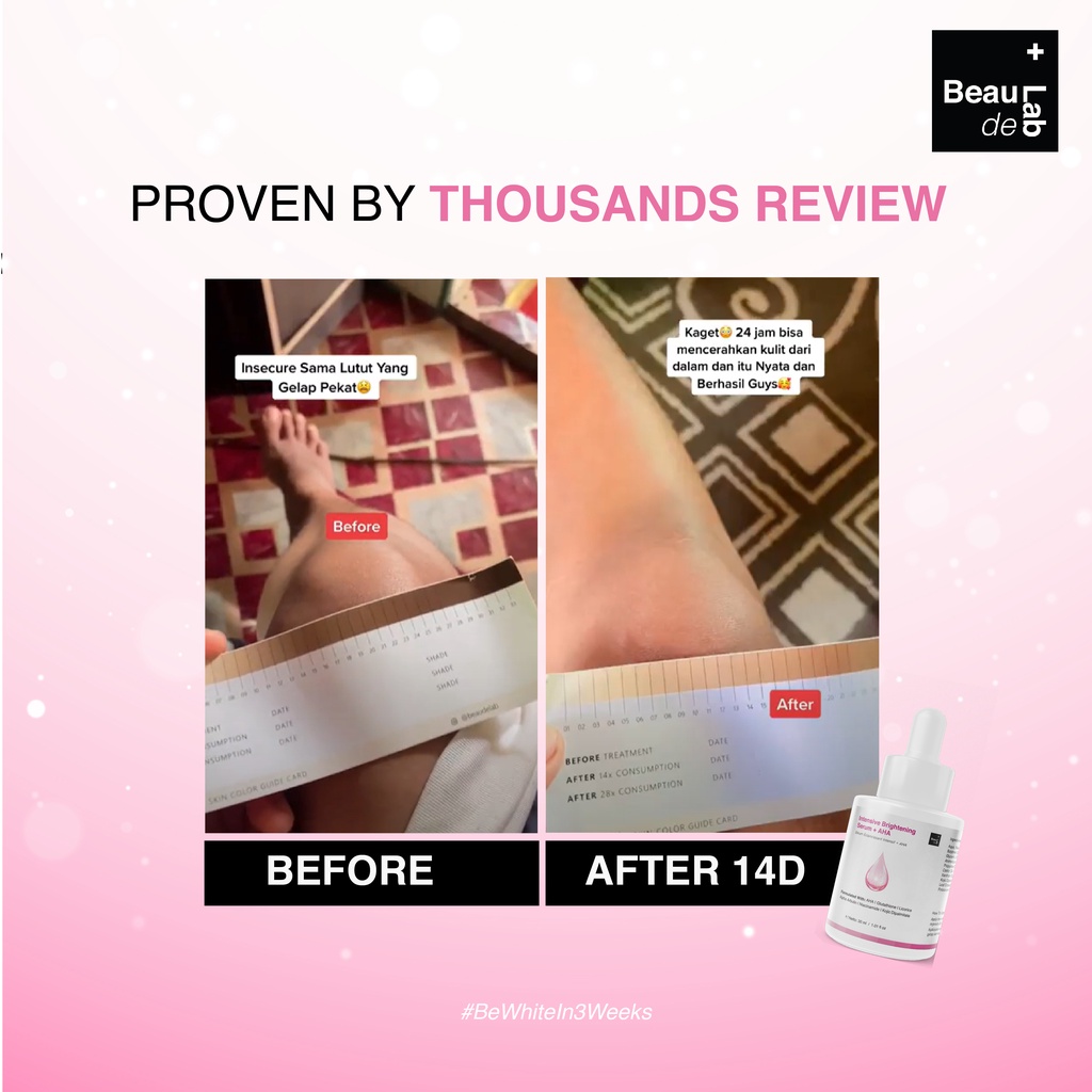 Beaudelab Underarm Brightening Serum AHA | Pemutih Ketiak Selangkangan Instan Cepat| Penghilang Bekas Luka-3