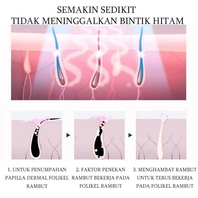 【Barang spot】Semprotkan cream Krim penghilang ​bulu encabutan rambut tanpa rasa sakit Ketiak, bulu kaki, jenggot,lengan,Dada,bagian pribadi hair removal spray Ringan dan tidak mengiritasi penghilang bulu permanen enghilang rambut cepat yang aman, lembut