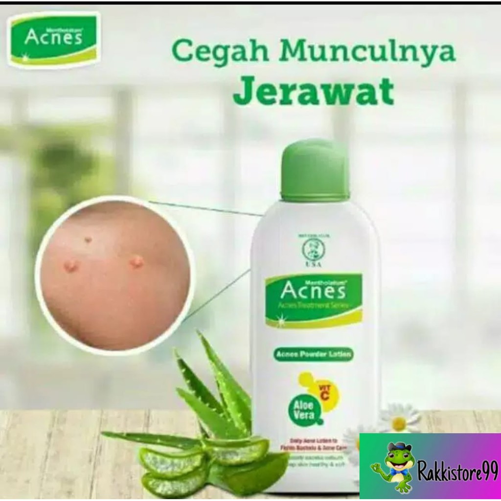 ❣️Rakkistore99❣️Acnes Powder Lotion 100ml (100% Original)