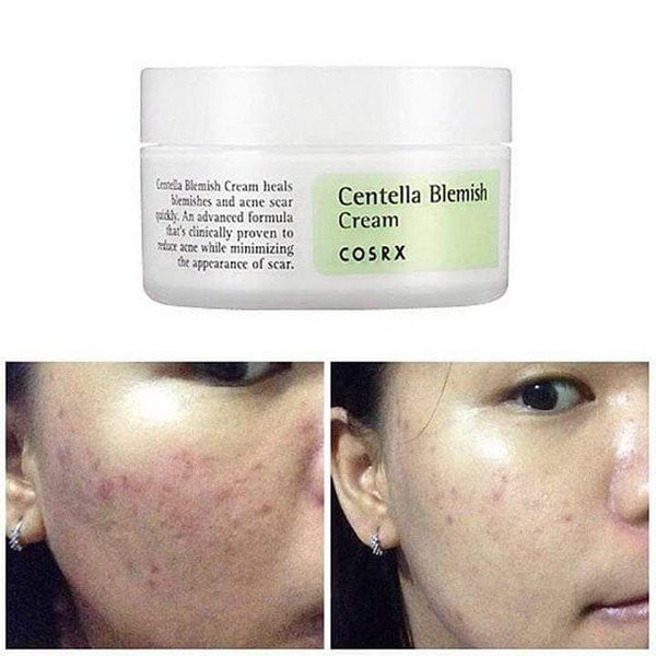 COSRX Centella Blemish Cream - 30gr