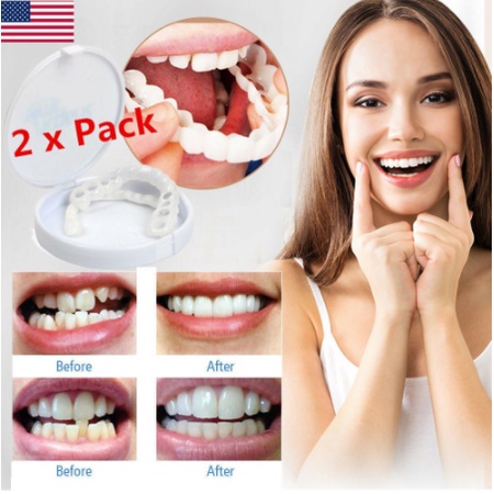 SNAP ON SMILE