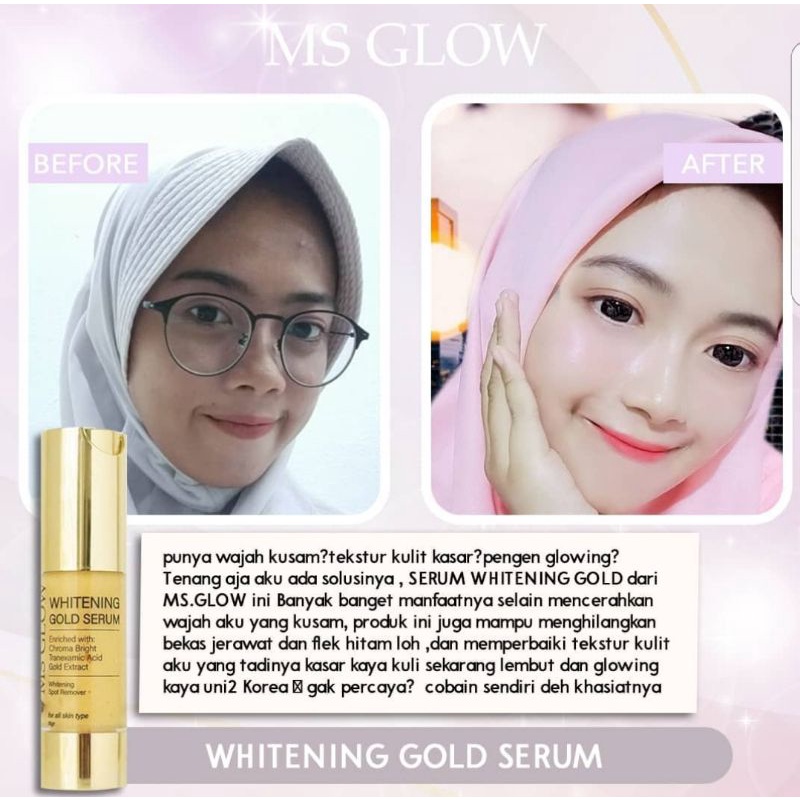 Serum Gold Whitening MS GLOW.