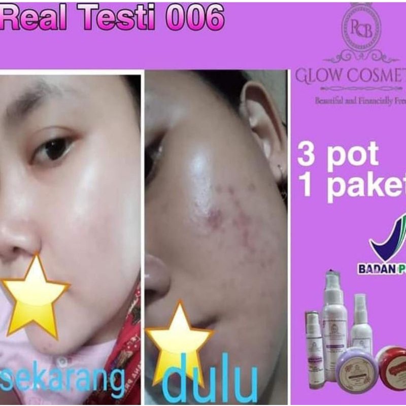 SHVA. Terlaris...(COD) Paket Rcb Glow Cosmetic Paket Krim Booster Rcb Glow Bpom Skincare Busui Bumil