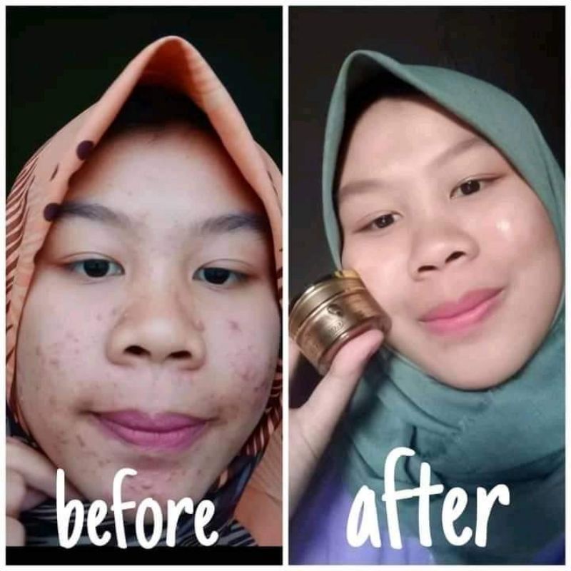 Kedas Beauty Gold Jelly 10gr-3