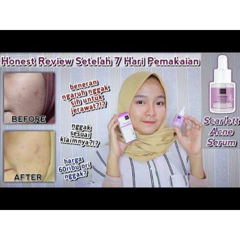 SCARLETT BRIGHTENING SERUM ACNE DAN SERUM BRIGHTLY - SCARLET BY FELICYA ANGELISTA