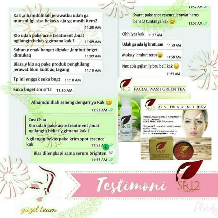 Sr12 Acne Treatment Cream - Perawatan Jerawat Untuk Muka Wajah Exclusive