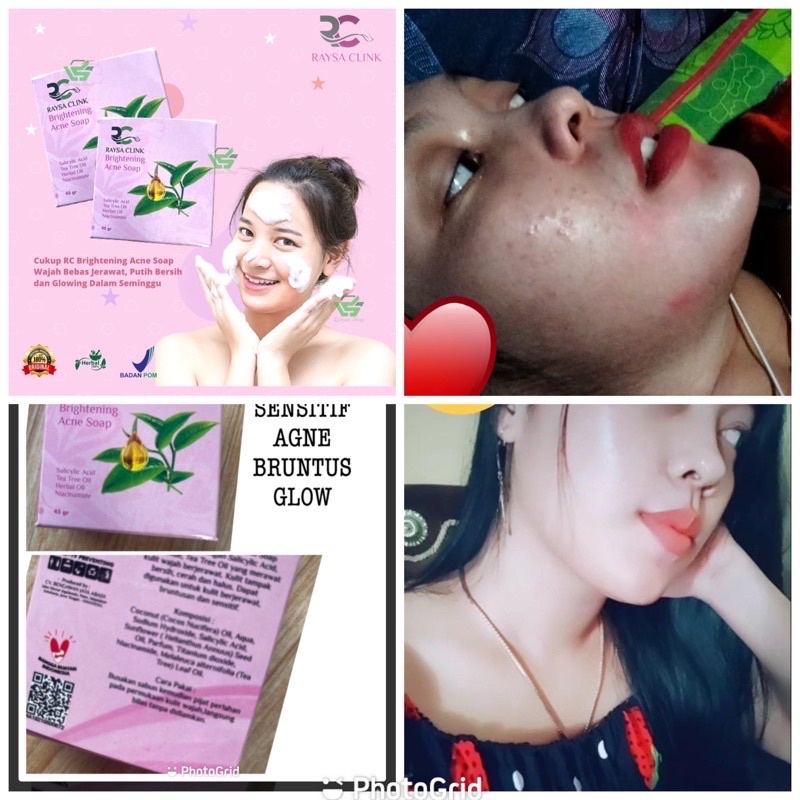 Raysa Clink Skincare RAYSA CLINK sabun agne raysa clink 88 88