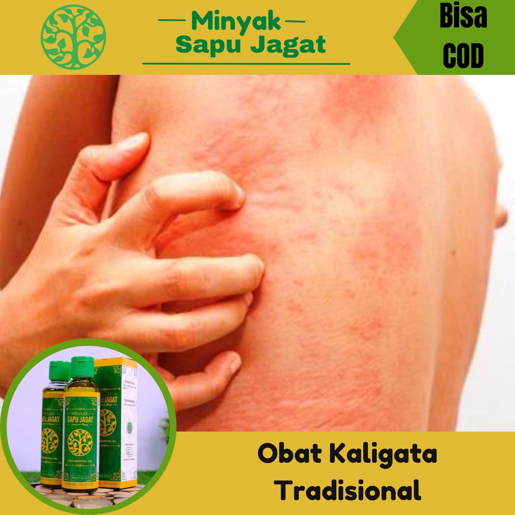 Jual Obat Kaligata Tradisional, Benjolan Di Sekujur Tubuh, Bintik