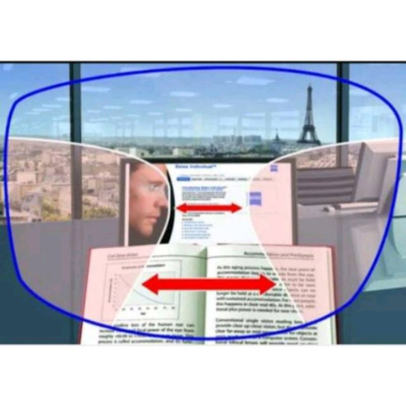 Penambahan lensa progresip minus/plus - khusus Lensa Alternative