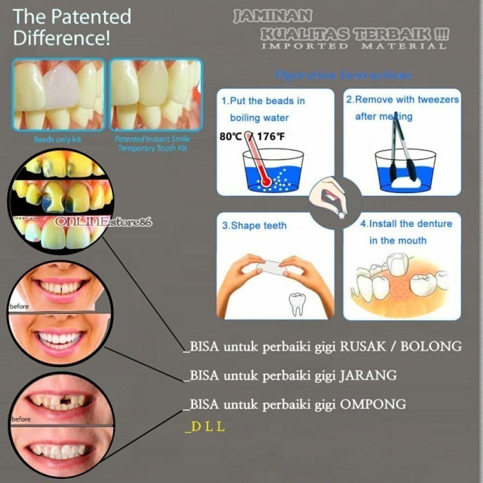 TEMPTOOTH - SOLUSI UNTUK GIGI BERLUBANG BELI 1PACK GRATIS 3PACK