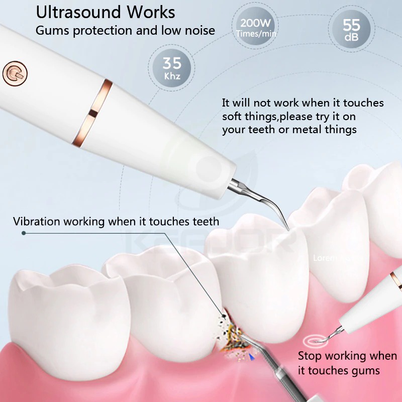 Pembersih Gigi Pembersih Karang Plak Gigi Ultrasonic Dental Calculus Electric - GS5 - White