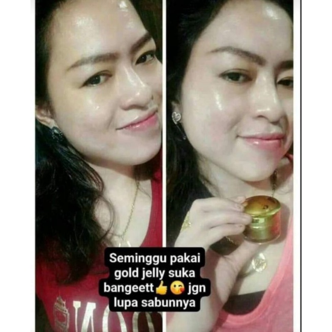 (READY STOK) GOLD JELLY KEDAS BEAUTY 100 % ORI + FREE GIFT-3