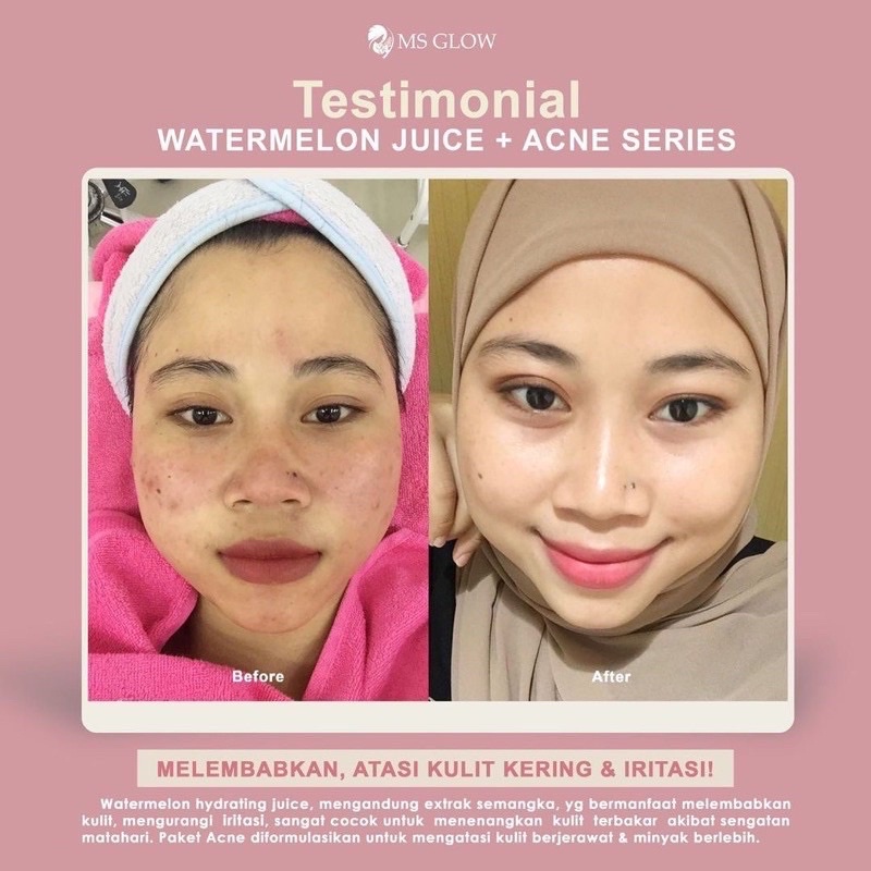 MOISTURIZER JUICE MS GLOW EDISI CHA EUN WOO