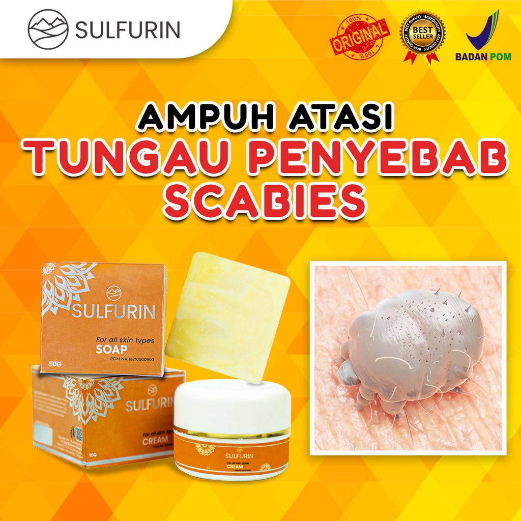 Sabun dan Salep SULFURIN BELERANG Mengatasi Gatal Pada Kulit Obat Skabies Herpes Kutu Air 100% Original BPOM Aman Untuk Segala Usia