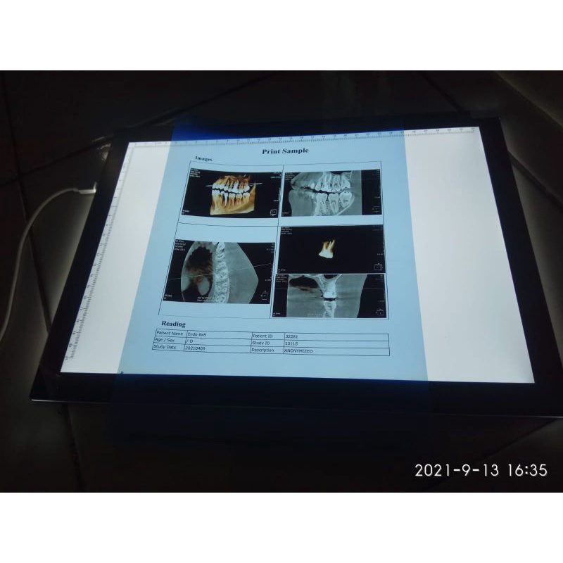 New Dental viewer X ray LED rontgen portable A4 slim series Shopee