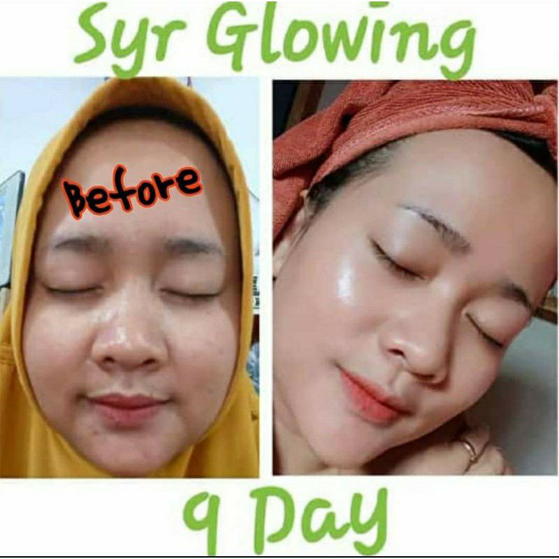 (COD) BPOM Paket Lengkap Skincare Syahreni Glowing Super Lengkap Komplit SYR original 100% Asli Ori Serum Gold Terbaru 2021 Versi Syahraeni Grosir Wajah Face mengatasi Jerawat Beruntusan Flek Hitam membandal perawatan terbaik Aman Skin Care Medan Resmi-6