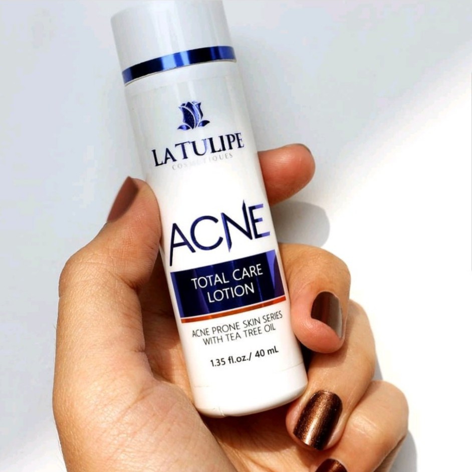 STAR La Tulipe Acne Total Care Lotion / Obat Jerawat Shopee Indonesia