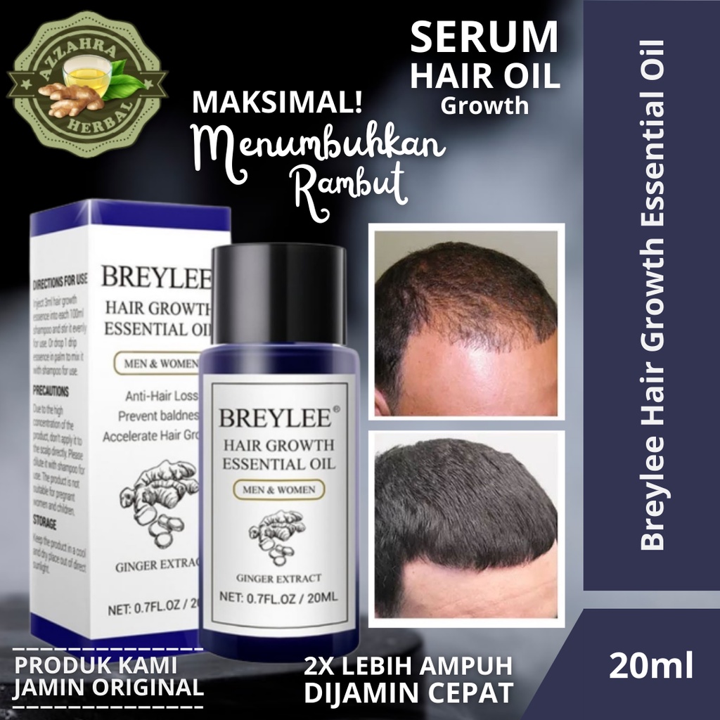 Serum Penumbuh Rambut Botak Rontok Genetik / Minyak Penumbuh Rambut - BREYLEE Hair Growth