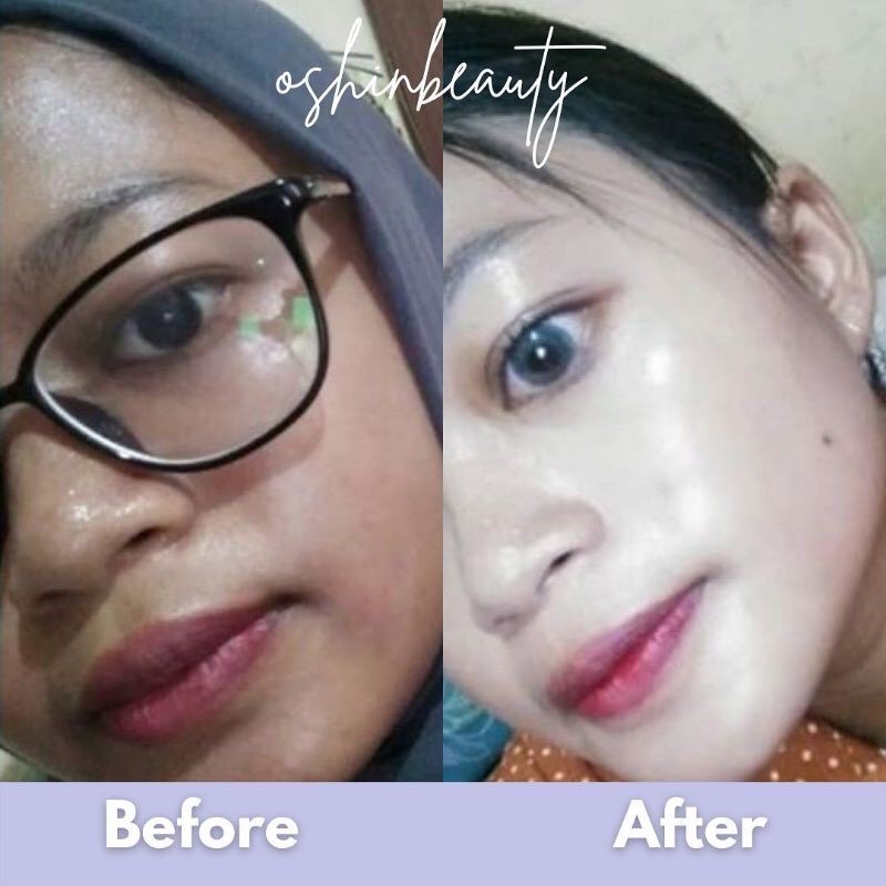(OSHINBEAUTY) Paket Skincare Glow dan Acne Series Complete BPOM [Free Gift/Bonus]-2