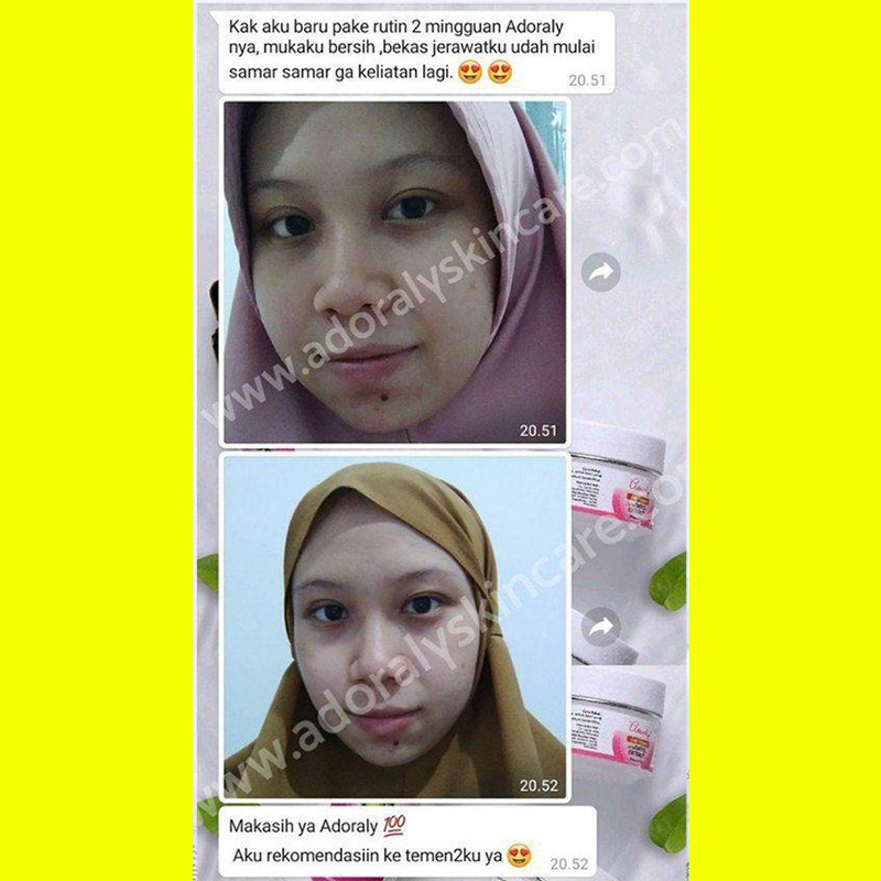 ADORALY SkinCare Original Flek Hilang CANTIK ALAMI