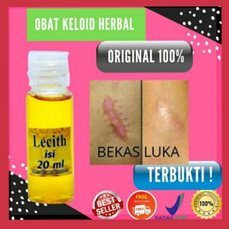 OBAT KELOID AMPUH PENUMPAS DAGING TUMBUH /KELOID /PENGHILANG BEKAS LUKA