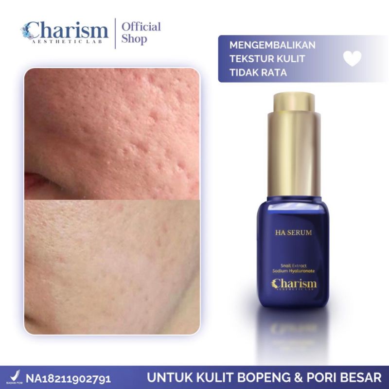 Pori Pori Besar / Charism Aesthetic / Serum Bopeng Ha / Serum Untuk Jerawat