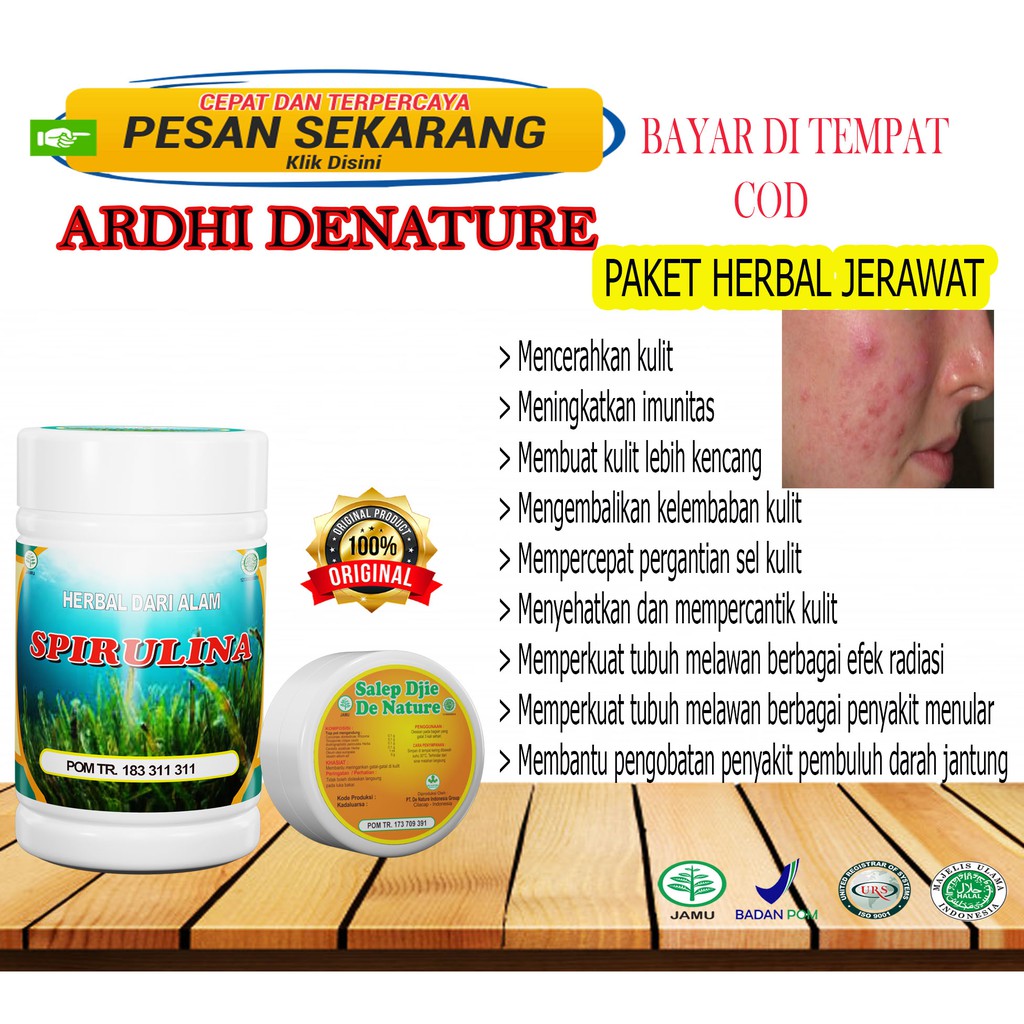 Paket obat dan salep herbal buat jerawat batu,obat jerawat gatal,obat jerawat basah pria wanita COD