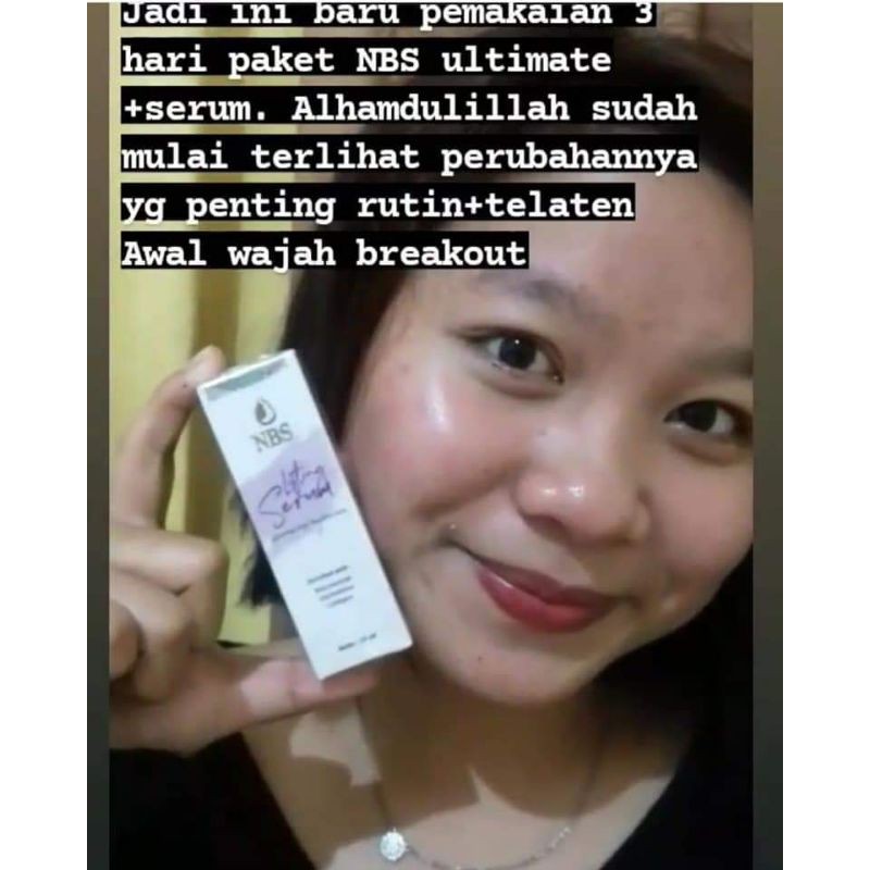 

LIFTINGSERUM NBS SKIN