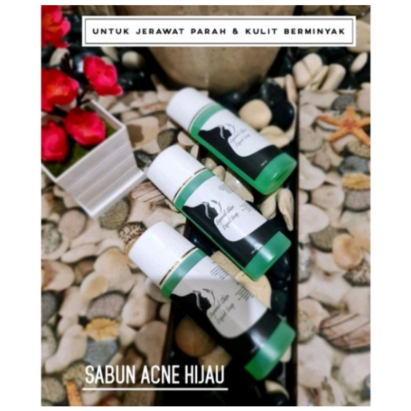 sabun acne jerawat parah Syamil skin || sabun hijau Syamil skincare