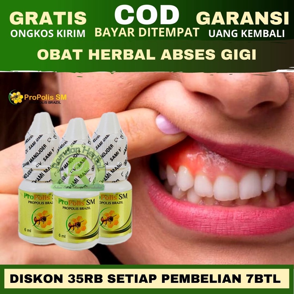 Obat Abses Gigi Oral Fistula Abses Gusi Sakit Gigi Gusi Bernanah Bau Mulut Propolis SM