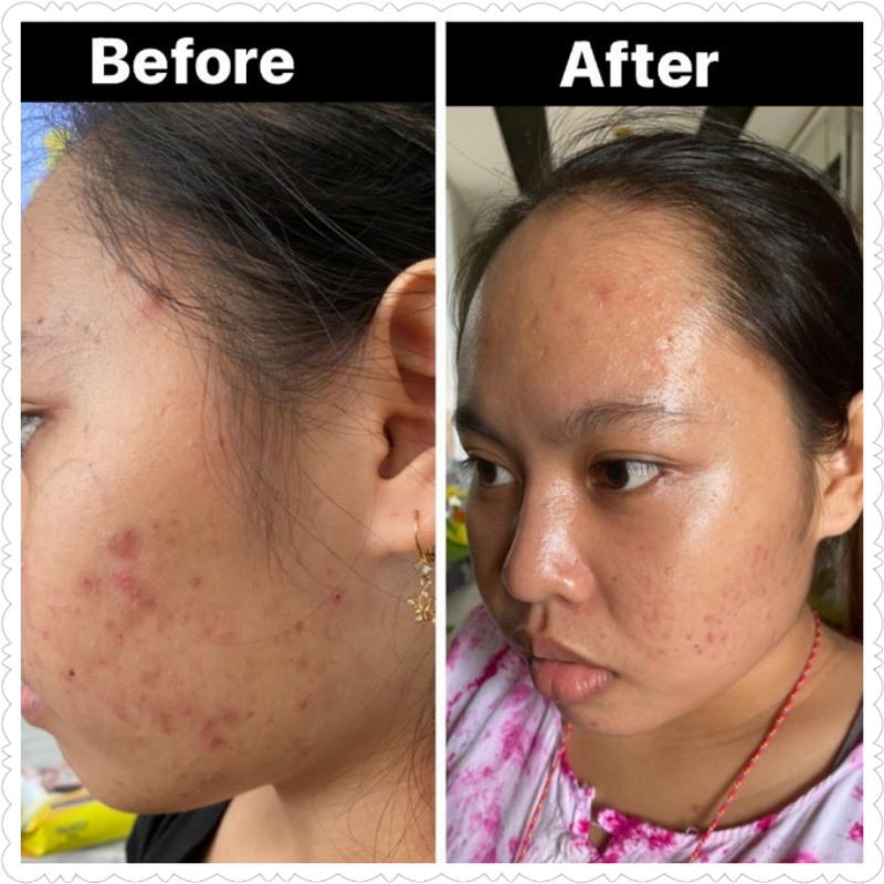 STEV Skincare by STEVIE AGNECIA Paket Glowing Kecantikan Memutihkan BPOM HALAL AMAN ORIGINAL